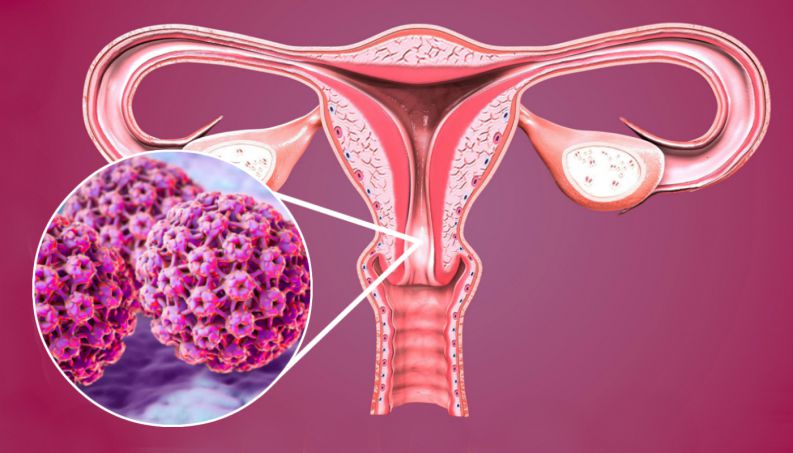 virus hpv virus hpv