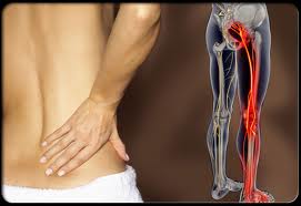 dây thần kinh tọa dây thần kinh tọa