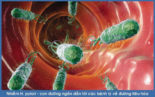 thủ phạm HP thủ phạm HP